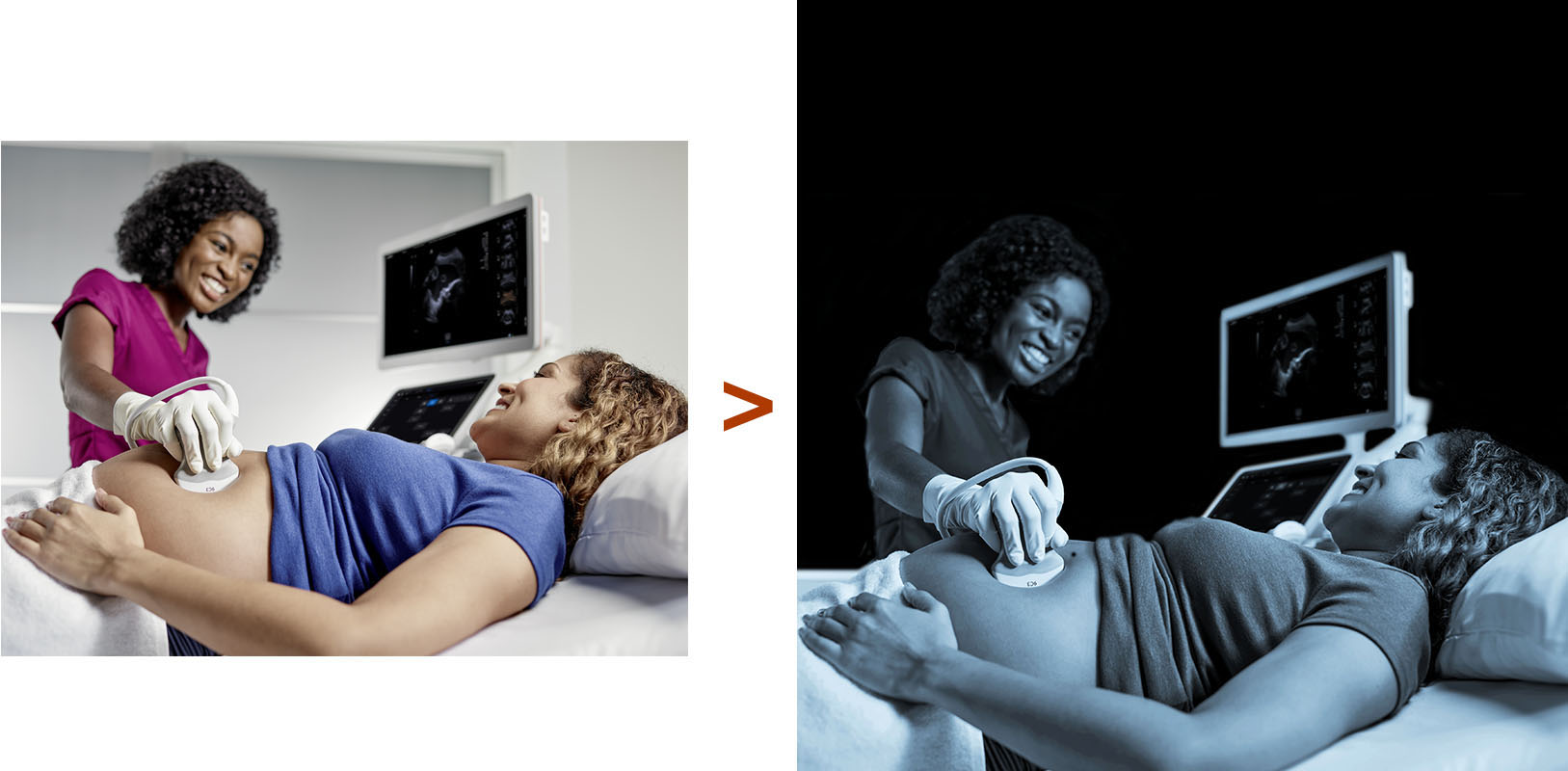 edição de fotos - antes e depois